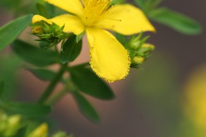 The photo shows common St. Johnswort flower petals.  They are yellow and dotted with black glands along the margins.